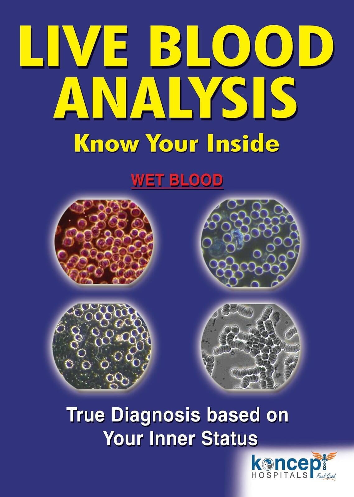 online analysis of blood test